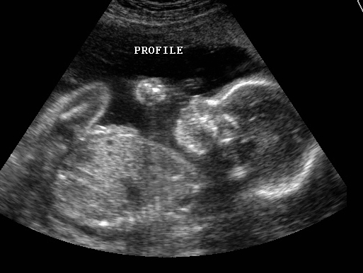2d_ultrasound(3).jpg